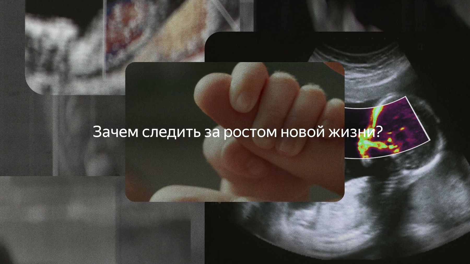 Кадр ролика (0:20): УЗИ и рука новорождённого, «Зачем следить за ростом новой жизни?»
